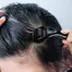 Derma Roller™ Roler Za Negu Tela