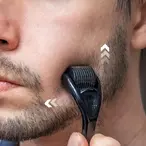 Derma Roller™ Roler Za Negu Tela