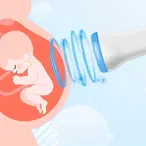 FETAL DOPPLER(BABY WATCHER) KUĆNI ULTRAZVUK 